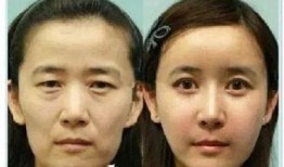 爆料整容诈骗案例最新,受害者血泪教训，警惕美丽陷阱